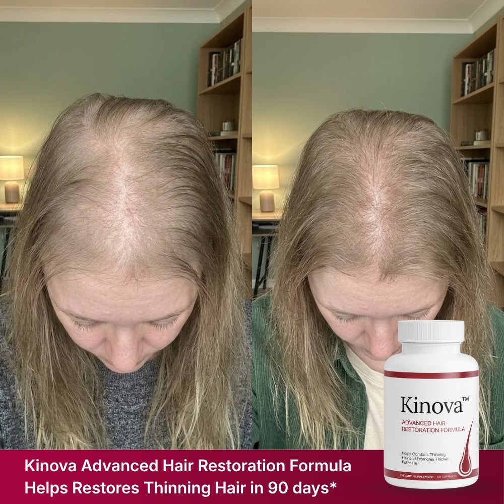 Kinova Hair Restoration Formula