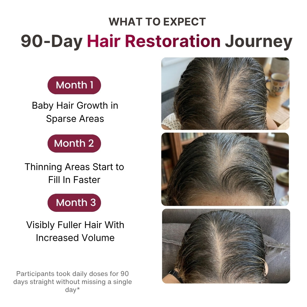Kinova Hair Restoration Formula