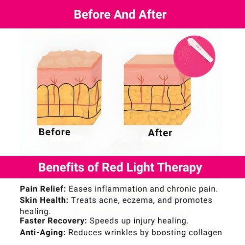 Kinova Red + Infrared Light Therapy Belt - KINOVA